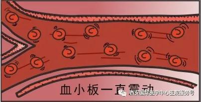 血小板是正常值的三倍？專家提醒小心血栓和出血！