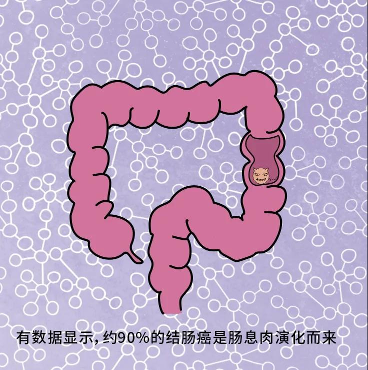 奪走“黑豹”生命的結(jié)腸癌，到底什么來頭？