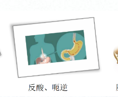 關(guān)愛身體健康，輕松檢查胃腸
