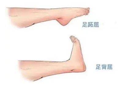 扭胯小連步、動(dòng)感搖花手……“科目三”雖火，運(yùn)動(dòng)損傷也要防！